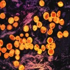 Что такое mpox: микробиолог объяснил, что известно об этом родственнике оспы