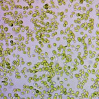 Микроводоросли могут компенсировать последствия укусов ядовитых змей